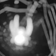 Blick von der Bergstation Ritzhagen